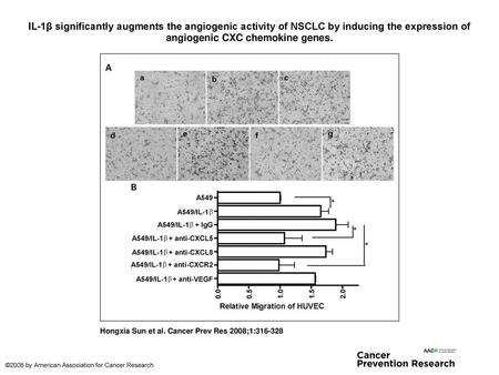 IL-1β significantly augments the angiogenic activity of NSCLC by inducing the expression of angiogenic CXC chemokine genes. IL-1β significantly augments.