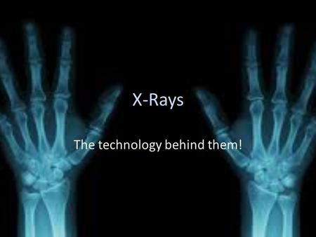 X-Rays The technology behind them!. The EM used The EM used for x ray machines is x-rays. X-rays are a type of electromagnetic radiation X-rays are basically.