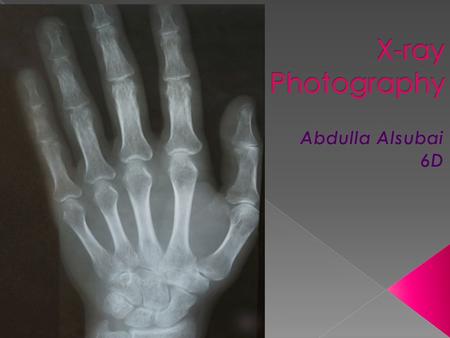  X-rays were discovered in 1895 by Wilhelm Conrad Röntgen, who received the first Nobel Prize in Physics in 1901.  Several important discoveries have.