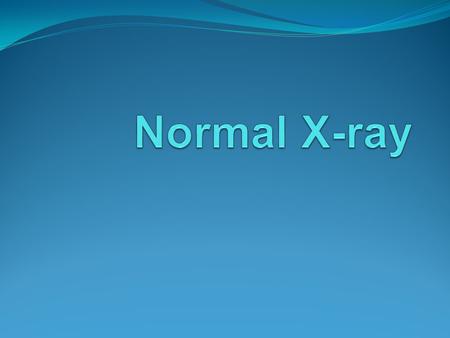Normal X-ray.