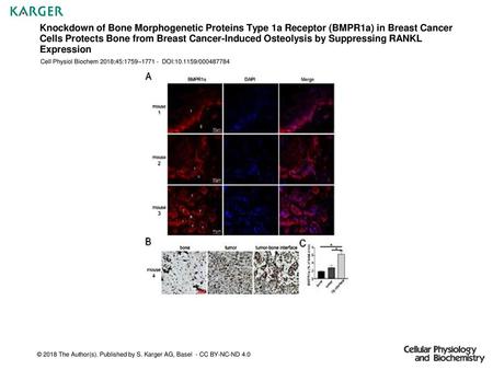 Knockdown of Bone Morphogenetic Proteins Type 1a Receptor (BMPR1a) in Breast Cancer Cells Protects Bone from Breast Cancer-Induced Osteolysis by Suppressing.