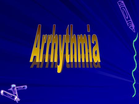 Arrhythmia Arrhythmia.