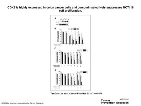 CDK2 is highly expressed in colon cancer cells and curcumin selectively suppresses HCT116 cell proliferation. CDK2 is highly expressed in colon cancer.