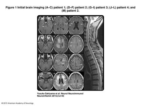 Figure 1 Initial brain imaging (A–C) patient 1; (D–F) patient 2; (G–I) patient 3; (J–L) patient 4; and (M) patient 2. Initial brain imaging (A–C) patient.