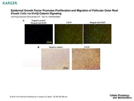 Epidermal Growth Factor Promotes Proliferation and Migration of Follicular Outer Root Sheath Cells via Wnt/β-Catenin Signaling Cell Physiol Biochem 2016;39:360-370.