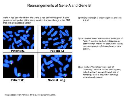 Rearrangements of Gene A and Gene B