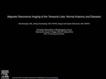 Magnetic Resonance Imaging of the Temporal Lobe: Normal Anatomy and Diseases  Alla Khashper, MD, Jeffrey Chankowsky, MD, FRCPC, Raquel del Carpio-O'Donovan,