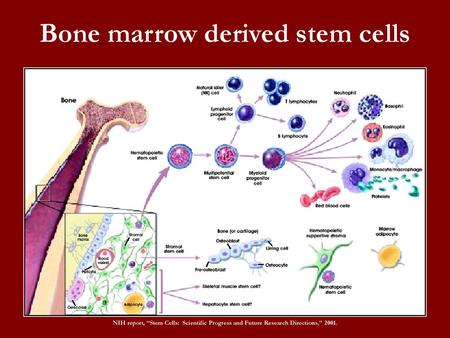 Bone marrow derived stem cells