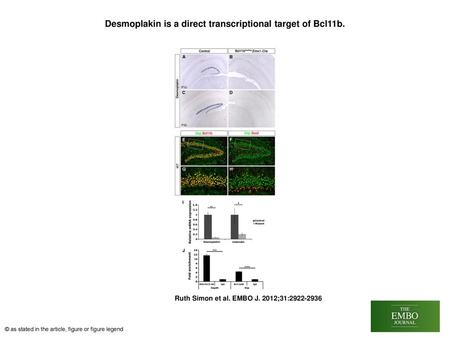 Desmoplakin is a direct transcriptional target of Bcl11b.
