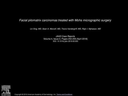 Facial pilomatrix carcinomas treated with Mohs micrographic surgery