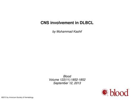 CNS involvement in DLBCL