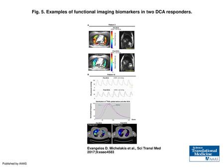 Examples of functional imaging biomarkers in two DCA responders