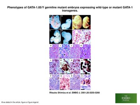 Phenotypes of GATA‐1.05/Y germline mutant embryos expressing wild‐type or mutant GATA‐1 transgenes. Phenotypes of GATA‐1.05/Y germline mutant embryos expressing.