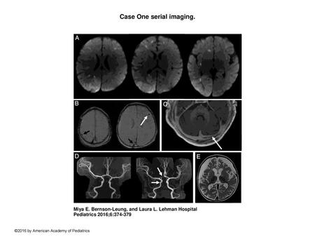Case One serial imaging.