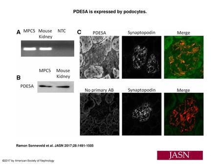 PDE5A is expressed by podocytes.