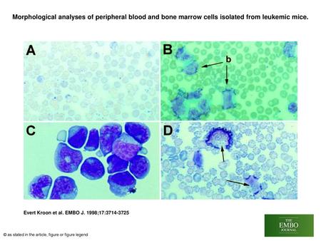 Morphological analyses of peripheral blood and bone marrow cells isolated from leukemic mice. Morphological analyses of peripheral blood and bone marrow.
