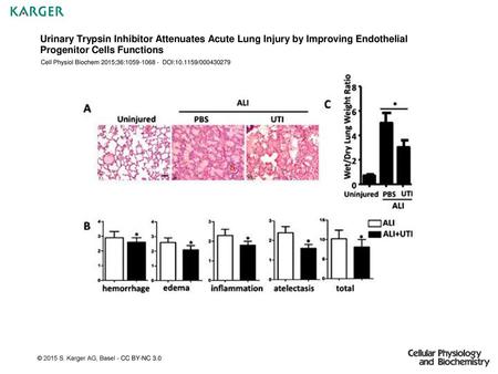 Urinary Trypsin Inhibitor Attenuates Acute Lung Injury by Improving Endothelial Progenitor Cells Functions Cell Physiol Biochem 2015;36:1059-1068 - DOI:10.1159/000430279.