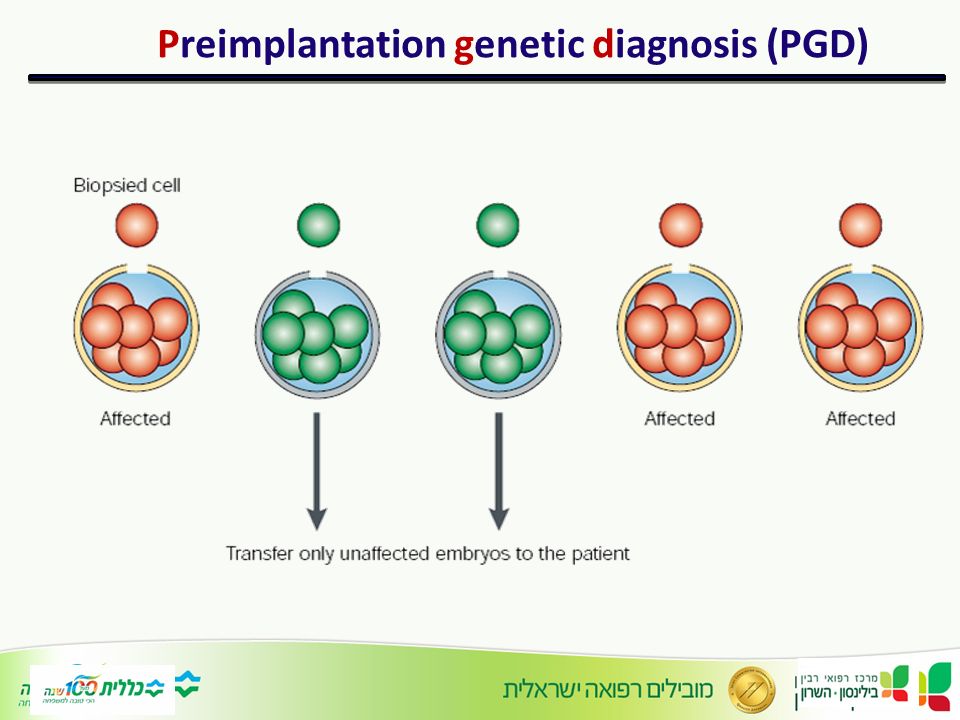 Preimplantation Genetic Diagnosis Sex Selection 7