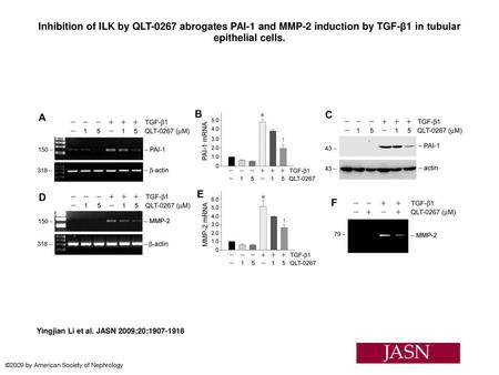 Inhibition of ILK by QLT-0267 abrogates PAI-1 and MMP-2 induction by TGF-β1 in tubular epithelial cells. Inhibition of ILK by QLT-0267 abrogates PAI-1.