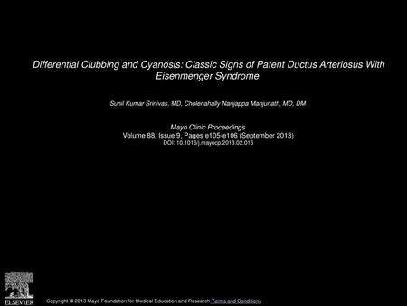 Differential Clubbing and Cyanosis: Classic Signs of Patent Ductus Arteriosus With Eisenmenger Syndrome  Sunil Kumar Srinivas, MD, Cholenahally Nanjappa.
