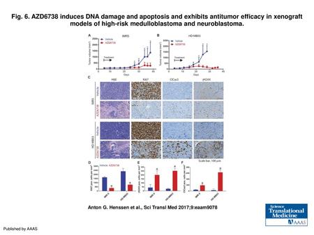 Fig. 6. AZD6738 induces DNA damage and apoptosis and exhibits antitumor efficacy in xenograft models of high-risk medulloblastoma and neuroblastoma. AZD6738.