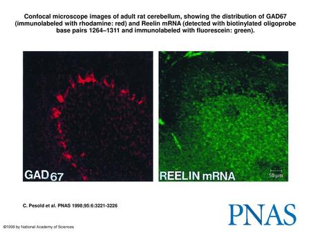 Confocal microscope images of adult rat cerebellum, showing the distribution of GAD67 (immunolabeled with rhodamine: red) and Reelin mRNA (detected with.