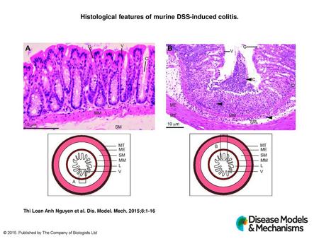 Histological features of murine DSS-induced colitis.
