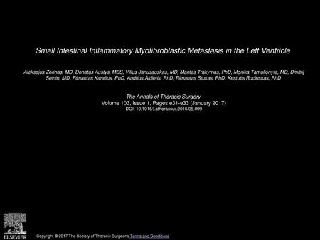 Small Intestinal Inflammatory Myofibroblastic Metastasis in the Left Ventricle  Aleksejus Zorinas, MD, Donatas Austys, MBS, Vilius Janusauskas, MD, Mantas.