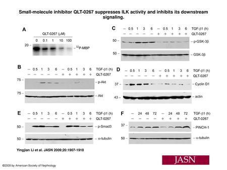 Small-molecule inhibitor QLT-0267 suppresses ILK activity and inhibits its downstream signaling. Small-molecule inhibitor QLT-0267 suppresses ILK activity.