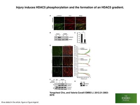 Injury induces HDAC5 phosphorylation and the formation of an HDAC5 gradient. Injury induces HDAC5 phosphorylation and the formation of an HDAC5 gradient.