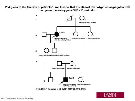 Pedigrees of the families of patients 1 and 2 show that the clinical phenotype co-segregates with compound heterozygous CLDN10 variants. Pedigrees of the.