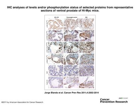IHC analyses of levels and/or phosphorylation status of selected proteins from representative sections of ventral prostate of Hi-Myc mice. IHC analyses.