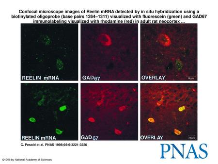 Confocal microscope images of Reelin mRNA detected by in situ hybridization using a biotinylated oligoprobe (base pairs 1264–1311) visualized with fluorescein.