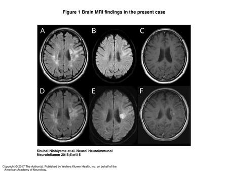 Figure 1 Brain MRI findings in the present case