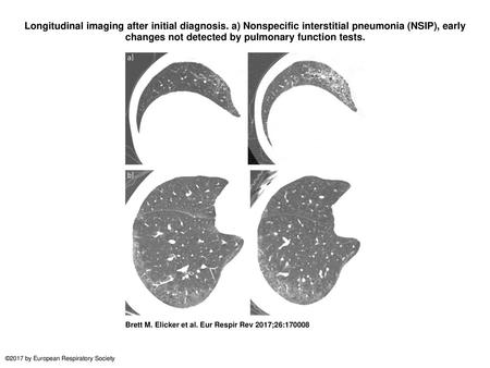Longitudinal imaging after initial diagnosis