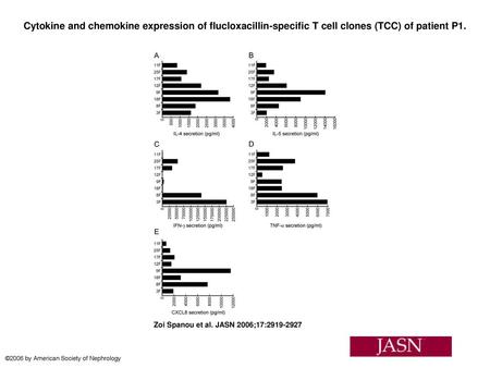 Cytokine and chemokine expression of flucloxacillin-specific T cell clones (TCC) of patient P1. Cytokine and chemokine expression of flucloxacillin-specific.