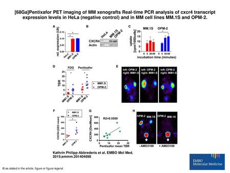 [68Ga]Pentixafor PET imaging of MM xenografts Real‐time PCR analysis of cxcr4 transcript expression levels in HeLa (negative control) and in MM cell lines.