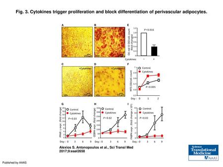 Fig. 3. Cytokines trigger proliferation and block differentiation of perivascular adipocytes. Cytokines trigger proliferation and block differentiation.