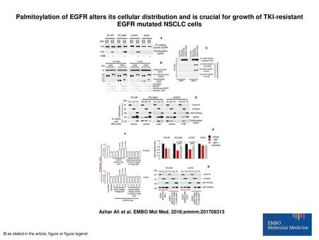 Palmitoylation of EGFR alters its cellular distribution and is crucial for growth of TKI‐resistant EGFR mutated NSCLC cells Palmitoylation of EGFR alters.