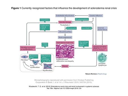 Figure 1 Currently recognized factors that influence the development of scleroderma renal crisis Figure 1 | Currently recognized factors that influence.