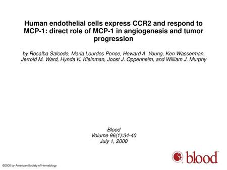 Human endothelial cells express CCR2 and respond to MCP-1: direct role of MCP-1 in angiogenesis and tumor progression by Rosalba Salcedo, Maria Lourdes.