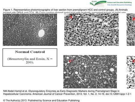 Figure 1. Representative photomicrographs of liver section from premalignant HCC and control groups. (A) Animals treated with DENA and CCl4. (B) Cross.