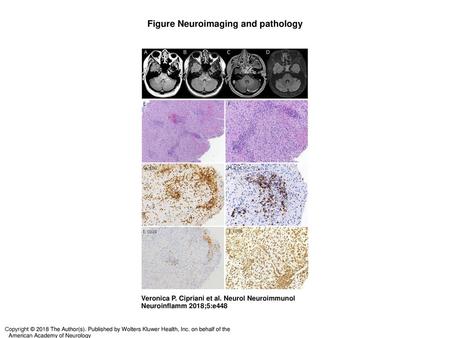 Figure Neuroimaging and pathology