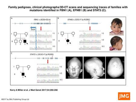 Family pedigrees, clinical photographs/3D-CT scans and sequencing traces of families with mutations identified in FBN1 (A), EFNB1 (B) and STAT3 (C). Family.