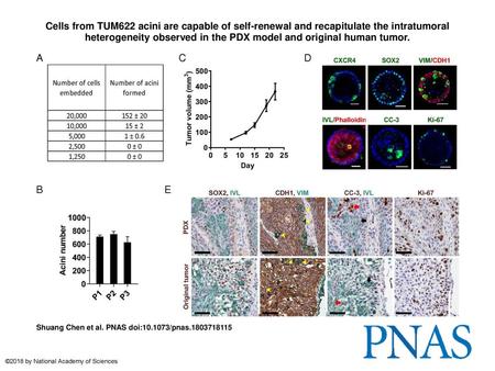 Cells from TUM622 acini are capable of self-renewal and recapitulate the intratumoral heterogeneity observed in the PDX model and original human tumor.