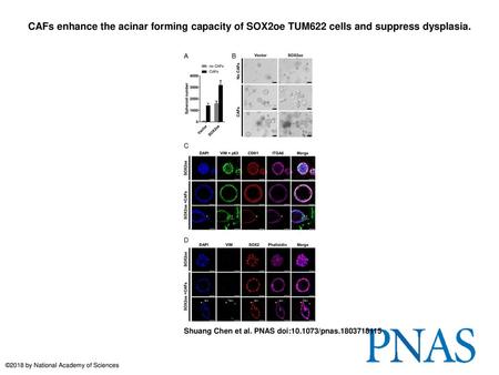 CAFs enhance the acinar forming capacity of SOX2oe TUM622 cells and suppress dysplasia. CAFs enhance the acinar forming capacity of SOX2oe TUM622 cells.