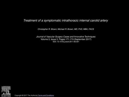 Treatment of a symptomatic intrathoracic internal carotid artery