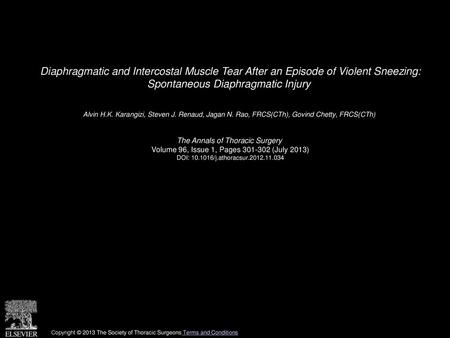 Diaphragmatic and Intercostal Muscle Tear After an Episode of Violent Sneezing: Spontaneous Diaphragmatic Injury  Alvin H.K. Karangizi, Steven J. Renaud,