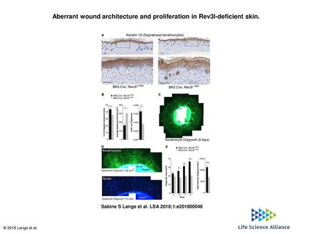 Aberrant wound architecture and proliferation in Rev3l-deficient skin.