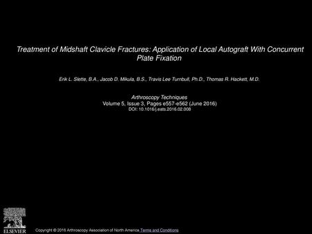 Treatment of Midshaft Clavicle Fractures: Application of Local Autograft With Concurrent Plate Fixation  Erik L. Slette, B.A., Jacob D. Mikula, B.S.,